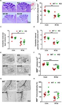 Selective Neural Deletion of the Atg7 Gene Reduces Irradiation-Induced Cerebellar White Matter Injury in the Juvenile Mouse Brain by Ameliorating Oligodendrocyte Progenitor Cell Loss